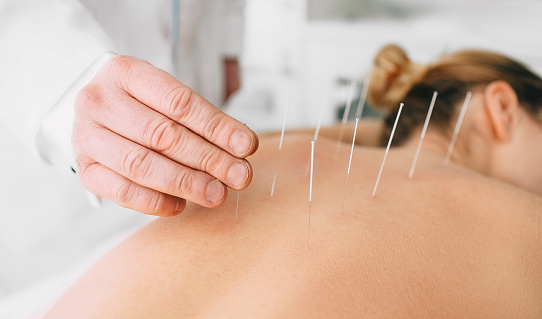 Acupuncture For Fertility In Morristown